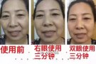 去除眼袋！去除黑眼圈！就是這麼簡單 【三分钟见效】微信：3214985723 