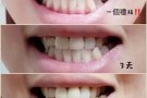 Dr.MIN净白牙粉
