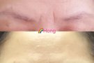 Eyebrow embroidery 