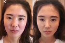 ❤️微整形象设计瘦脸瘦肩瘦腿水光针去皱大Ｖ除腋下异味