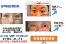 新加坡第一品牌｛爱眼净眼健康调理｝也可嫁接到新加坡的各大美容院的一个商机项目
