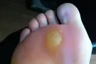 上门， 修甲沟炎 修灰指甲，采耳，治疗肩颈椎，等……