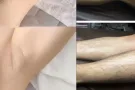 男士体毛管理 / spa 按摩
