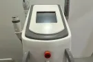 脱毛机