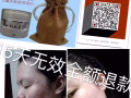 祛痘膏，專治痘痘，痘印，美白，控油，承諾十五無效全額退款。