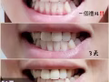 Dr.MIN凈白牙粉