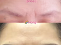 Eyebrow embroidery 