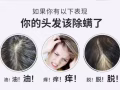 控油，除螨，修复受损头发还你青春！