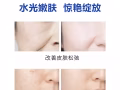 韩国水光针，保证一次见效