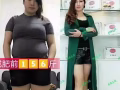 養森瘦瘦包