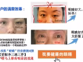 新加坡第一品牌｛愛眼凈眼健康調理｝也可嫁接到新加坡的各大美容院的一個商機項目
