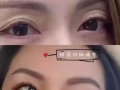 水光除皺抗衰提升
